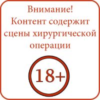 18plus