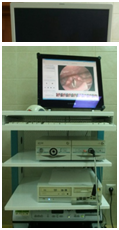 видеостроболарингоскоп XION medical